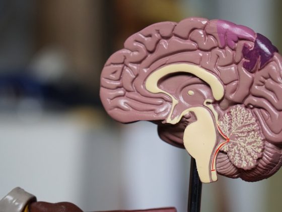 Photo Brain scan