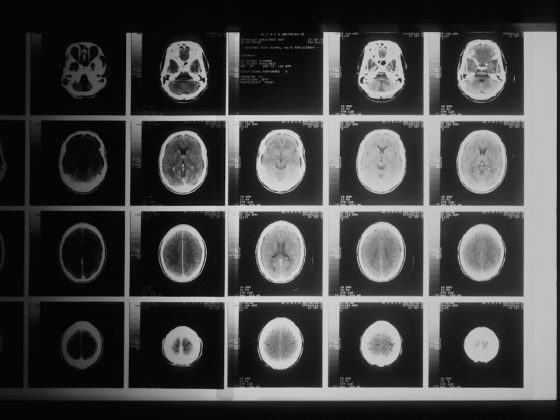 Photo Brain scan